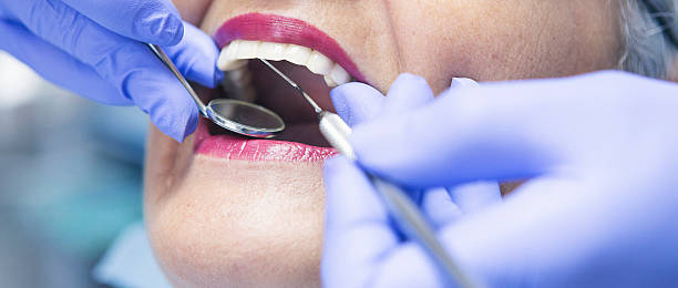 Best Teeth Whitening  in Mount Ora, OH